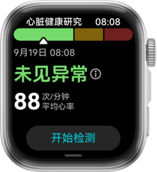 HUAWEI WATCH FIT 4 心脏健康